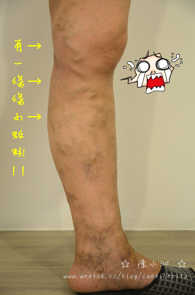 【保養】firo舒適型壓力襪 – 降低水腫好幫手、意外顯瘦!!!